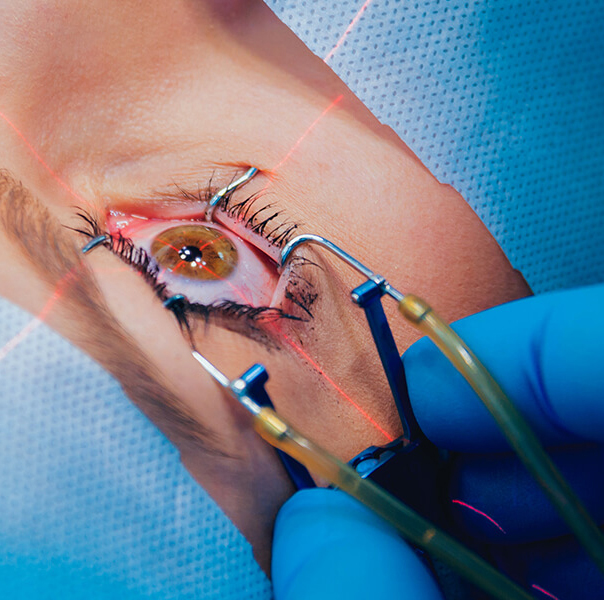 Cornea and refractive consultant | Cornea and refractive consultant | MEDOC